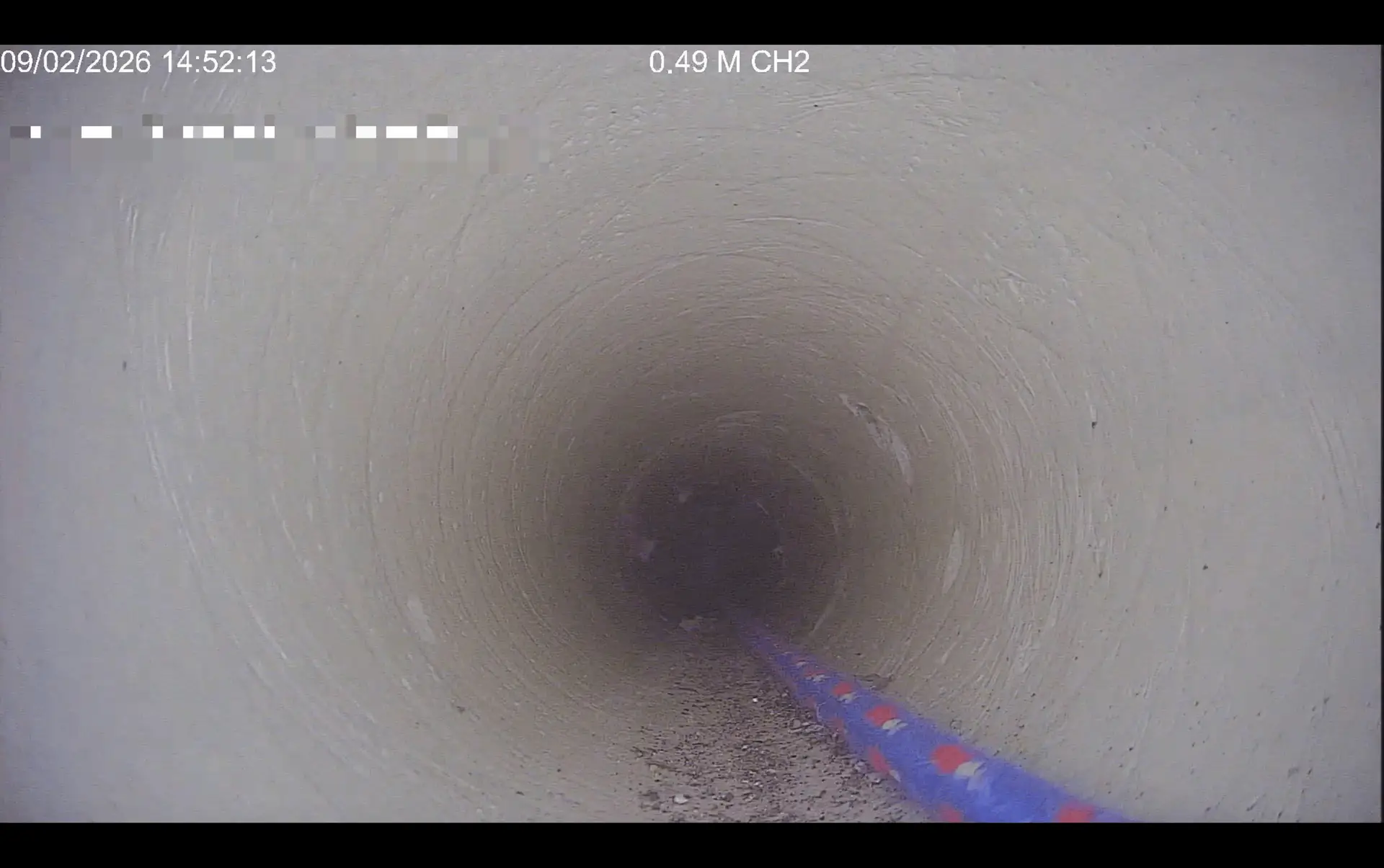 Prije STENT sanacije cijevi